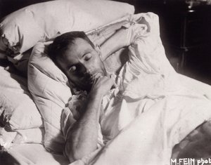 Egon Schiele on His Deathbed by Martha Fein