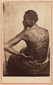 The Scourged Back, c. 1863 by McPherson & Oliver