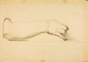 Arm of Child of Hiram Powers by Miner Kilbourne Kellogg