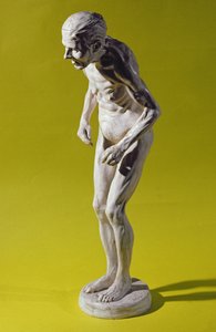 Figure of a woman with Parkinson