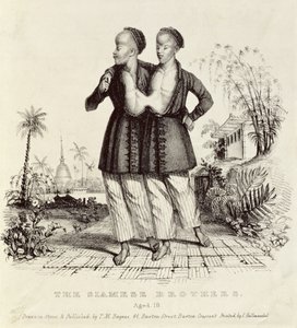 The Siamese Brothers, Aged 18, printed by Charles Hullmandel by Thomas Mann Baynes