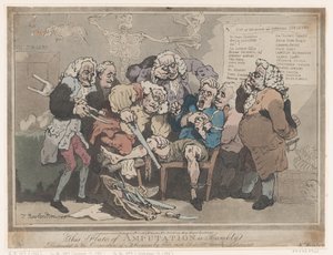 Amputation, February 17, 1786