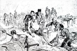 Ambroise Pare tying off arteries after amputation by Unbekannt