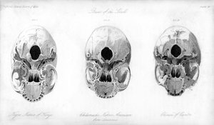 Base of the Skull by Unbekannt