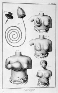 Breast Surgery by Unbekannt