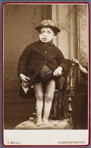 Diseases, Rickets Child with rickets