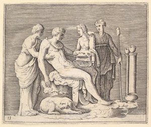 Man Attended by Three Women by Unbekannt