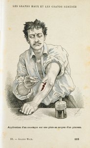 Painting a Wound with an Antiseptic Solution by Unbekannt