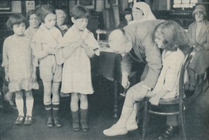 Testing the Patella Reflex for Indication of Nervous Disease