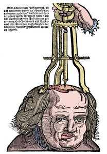 Trephination