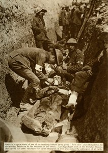 Wounded Soldier Being Treated in the Trenches, Battle of the Somme, First World War, 1916 by Unbekannt