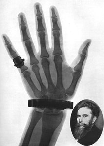 X-ray photograph of a hand, 1926 by Unbekannt