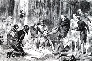 Ambroise Pare Removing a Lance from the Face of the Duc de Guise