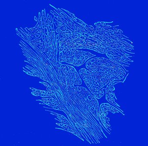 Crossing section of fibro-nucleated tumors by Unbekannter Künstler