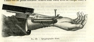 Direct sphygmograph by Unbekannter Künstler