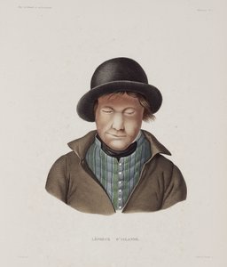 Leprosy Male leper, Iceland, early 19th century by Unbekannt