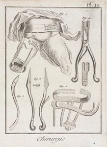 Early-Modern Orthopaedic surgery by Unbekannt