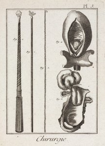 Early-Modern Surgical Instruments and Diagrams of Body Parts by Unbekannt