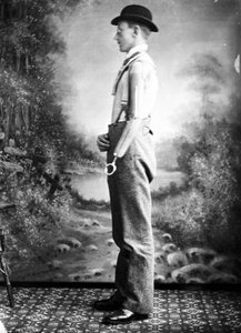 Man wearing an artificial arm