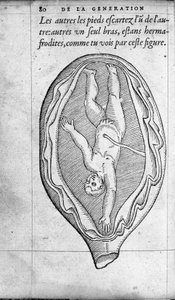 The Position of the Fetus in the Uterus During Pregnancy. Engraving from 