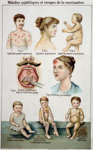 Plate illustrating the different forms of syphilitic diseases and the dangers of vaccination in 