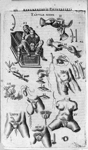 Surgical Interventions on the Female and Male Sexes