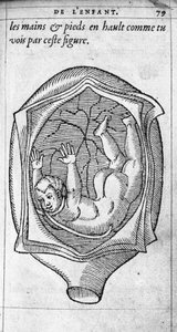 The position of the fetus in the uterus during pregnancy. Engraving from “De la generation des enfants” by French doctor and surgeon Ambroise Pare (1509-1590) 16th century by Unknown artist