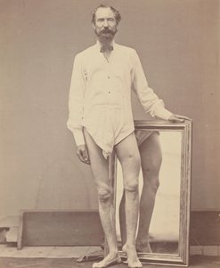 Gunshot Wound of Middle Third of Left Femur