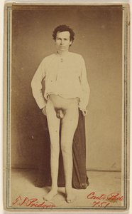 T.F. Pridgeon, Civil War Victim