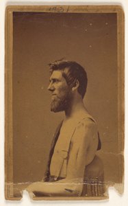 Unidentified Civil War Victim in Profile, Seated
