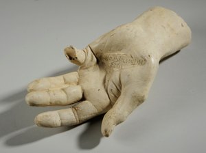 Cast of a hand
