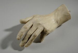 Cast of a hand
