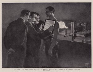 Wounded from the Front, locating a Mauser Bullet by X Rays in a London Hospital