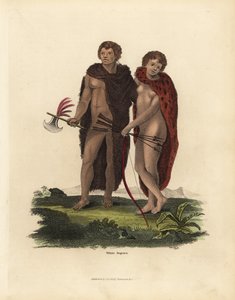 Albino African man and woman