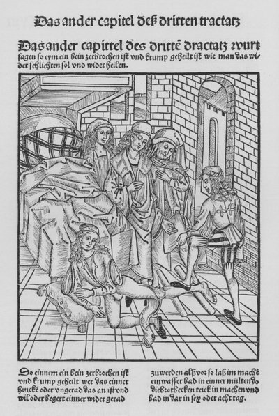 The Book of Cirurgia by Hieronymus Brunschwig by (after) German School