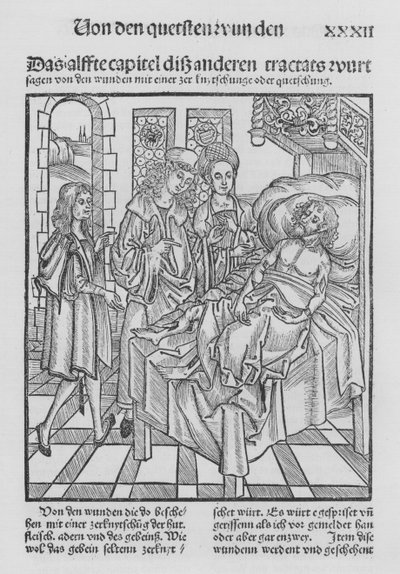 The Book of Cirurgia by Hieronymus Brunschwig by (after) German School