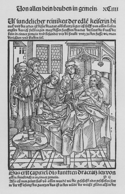 The Book of Cirurgia by Hieronymus Brunschwig by (after) German School