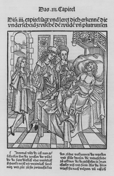 The Book of Cirurgia by Hieronymus Brunschwig by (after) German School