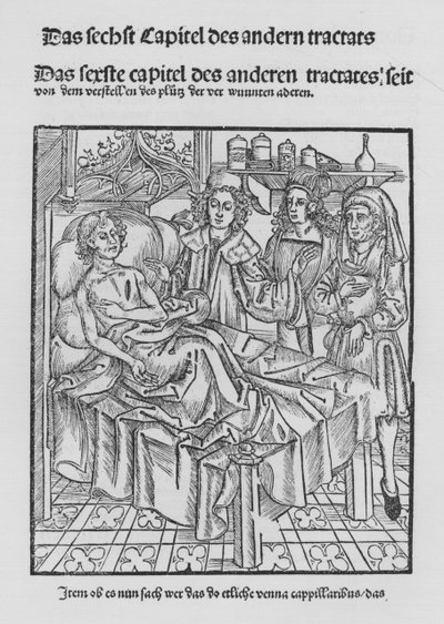 The Book of Cirurgia by Hieronymus Brunschwig by (after) German School