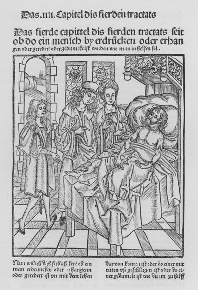 The Book of Cirurgia by Hieronymus Brunschwig by (after) German School