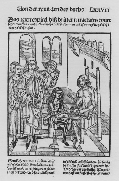 The Book of Cirurgia by Hieronymus Brunschwig by (after) German School