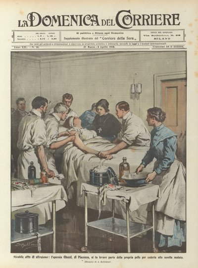 Wonderful act of altruism, the worker Ghezzi, from Piacenza, has part of her own skin removed by Achille Beltrame