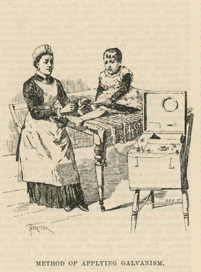 The West End Hospital for Paralysis and Epilepsy, Welbeck Street, London: Method for Applying Galvanism by Amedee Forestier
