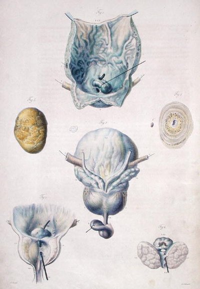 Diseases of the bladder and prostate, from 