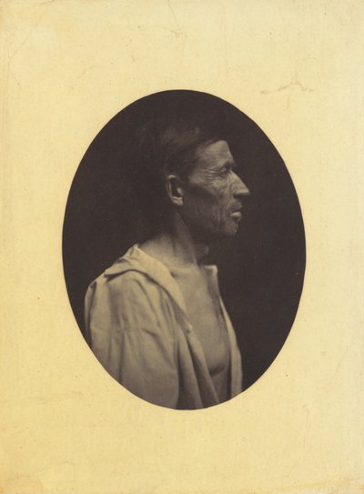 A portrait, seen in profile, of a man 42 years old, stupefied by the abuse of alcohol, 1854-1856 by Duchenne de Boulogne