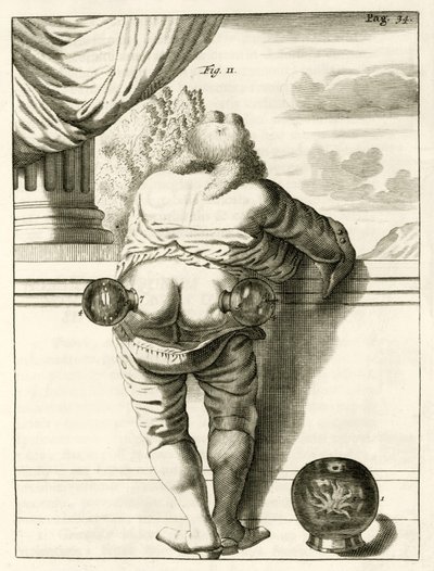 An example of cupping, from Exercitationes Practicae circa Medendi Methodum by Frederik Dekkers, 1694 by Dutch School