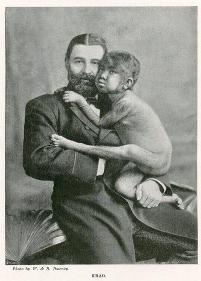 Krao, The Missing Link, Exhibited at the Aquarium, Westminster, London, in 1887 by English Photographer