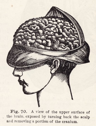 A view of the upper surface of the brain, exposed by turning back the scalp and removing a portion of the cranium by English School