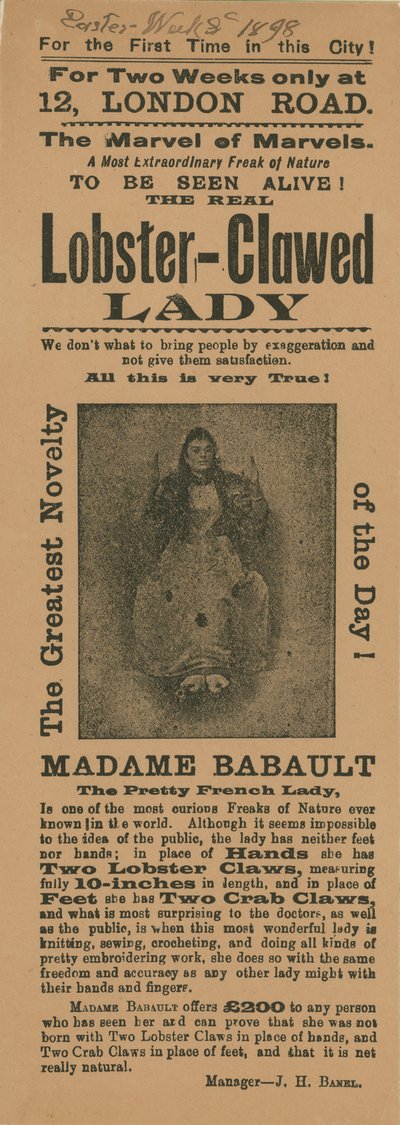 Advert for an Appearance of Madame Babault, the Lobster-Clawed Lady by English School