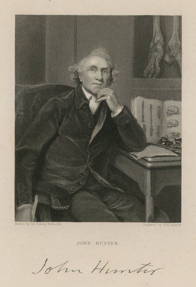 John Hunter by English School